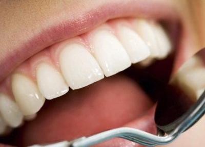 نسخه طبیعی برای مقابله با جرم دندان